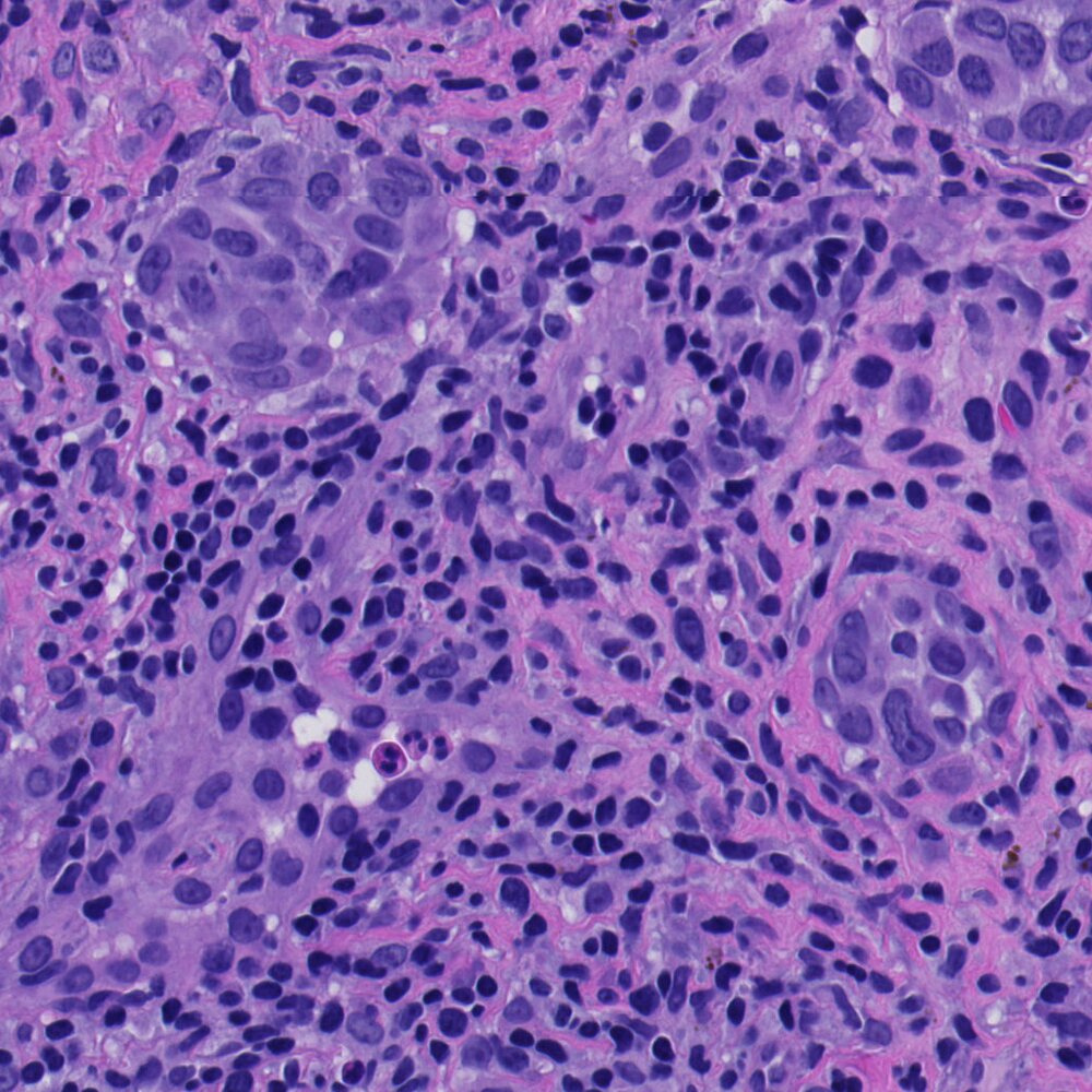 Pathology region of interest